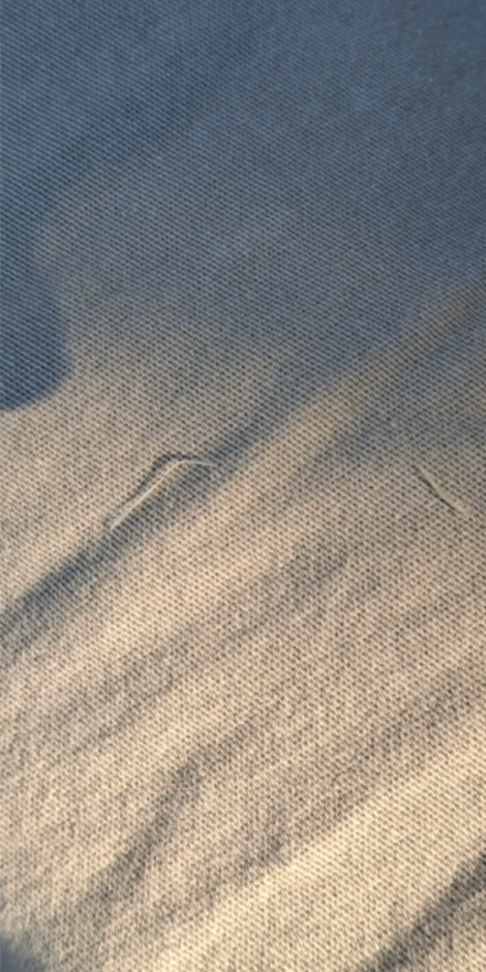 This is after a PEMF H-field session at the harmonics of the CCP nano-biochem parasite that has a weaponized form of "neural lace" where PLA and MSS jacked DARPA's neural lace and weaponized it. This could also be destroyed DARPA neural lace due to CCP nano-biochem parasite during decontamination.